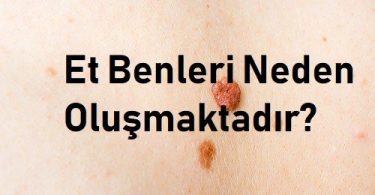 Et Benleri Neden Oluşmaktadır?