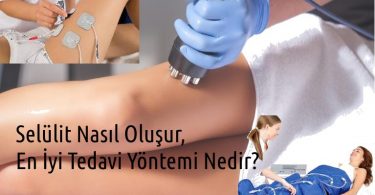 Selülit Nasıl Oluşur, En İyi Tedavi Yöntemi Nedir?