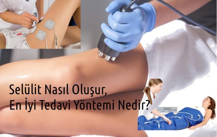 Selülit Nasıl Oluşur, En İyi Tedavi Yöntemi Nedir?